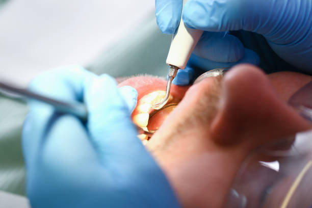 Best Broken or Chipped Tooth Repair in Estelle, LA